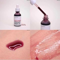 Tinh Chất Peel Tái Tạo Da So Natural Red Peel Tingle Serum 35ml - Hỗ Trợ Làm Sáng Da, Giảm Mụn Đầu Đen, Mờ Thâm