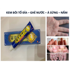 Kem Bôi Đông Y Chữa Nấm Ngứa 15g - Hiệu Quả Nhanh Chóng, Điều Trị Viêm Da, Dị Ứng và Nấm Tay Chân