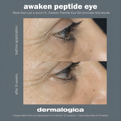 Kem dưỡng mắt Dermalogica Awaken Peptide Depuffing Eye Gel 6ml - Giúp giảm quầng thâm, bọng mắt, làm trẻ hóa da vùng mắt.