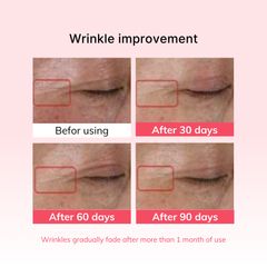 Combo Mặt Nạ Thạch Collagen IMU 4 Miếng + Tinh Chất Ampoule 50ml - Dưỡng Ẩm Chống Lão Hóa, Làm Sáng Da Hàn Quốc