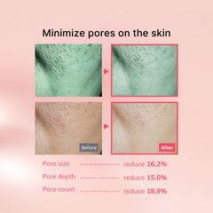 Combo Mặt Nạ Thạch Collagen IMU 4 Miếng + Tinh Chất Ampoule 50ml - Dưỡng Ẩm Chống Lão Hóa, Làm Sáng Da Hàn Quốc