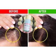 Tinh Chất Mọc Tóc Sato Arovics 5% Nhật Bản 30ml - Kích Thích Mọc Tóc Khỏe Mạnh, Giảm Gãy Rụng, An Toàn cho Da Đầu