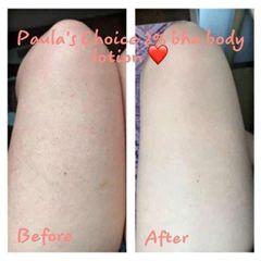 Kem Dưỡng Thể Paula's Choice BHA 2% - Chăm Sóc Da Mềm Mại & Sáng Màu 210ml, Giải Pháp Cho Làn Da Khỏe Mạnh