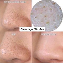 Mặt Nạ Innisfree Super Volcanic Pore Clay Mask 100ml - Se Khít Lỗ Chân Lông, Kiểm Soát Dầu, Sản Phẩm Chăm Sóc Da Hàn Quốc 2023