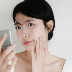 Essence D Program Giảm Mụn & Làm Mờ Vết Thâm 15g - Sữa Dưỡng Da Nhật Bản, Kiểm Soát Dầu, An Toàn Cho Da Nhạy Cảm