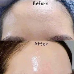 Serum Dưỡng Ẩm Phục Hồi Da GoodnDoc Hydra B5 30ml - Serum Chất Lượng Ngăn Ngừa Lão Hóa, Trẻ Hóa Làn Da, Dưỡng Sáng Da