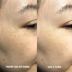 Tinh Chất Giảm Thâm Nám Dạng Bút Chấm EUCERIN UltraWHITE+ SPOTLESS SPOT CORRECTOR 5ml - Giúp Làm Sáng Da, Giảm Đốm Nâu, Dễ Dàng Sử Dụng