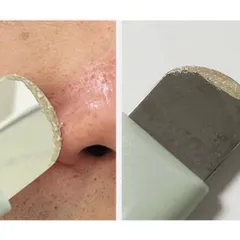 Thanh đẩy mụn ILSO - Thiết bị làm đẹp giúp loại bỏ mụn và bã nhờn hiệu quả, sản phẩm hot cuối tuần này!