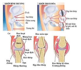 Nước Uống Bổ Sung Glucosamine Wellesse 1000ml - Hỗ Trợ Khớp & Xương Khỏe Mạnh, Hàng Nhập Mỹ