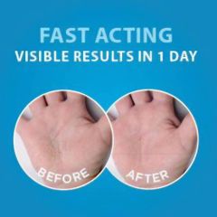 Kem Dưỡng Da Tay Dermal Therapy 50g - Giữ Ẩm, Bảo Vệ Da Tay Khỏi Tác Động Môi Trường, Sản Phẩm Chăm Sóc Da Chất Lượng Cao