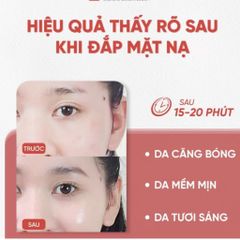 Mặt Nạ PDRN Kyunglab 23ml - Mặt Nạ Dưỡng Ẩm Căng Bóng Đặc Biệt Chăm Sóc Da Hàn Quốc, Phục Hồi Da Hư Tổn