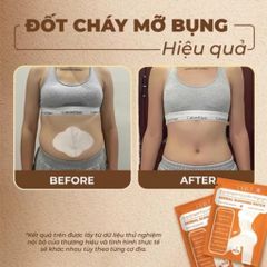 Miếng Dán Tan Mỡ Bụng Ohio Herbal Slimming Patch - Giảm Cân Nhanh Chóng Cho Vòng Eo Thon Gọn, An Toàn Từ Thiên Nhiên