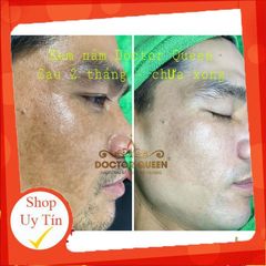Kem Nám Doctor Queen - Kem Chăm Sóc Da Làm Sáng, Ngừa Nám Chân Sâu Và Tàn Nhang, Giải Pháp Cho Da Sáng Mịn