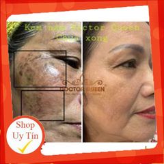 Kem Nám Doctor Queen - Kem Chăm Sóc Da Làm Sáng, Ngừa Nám Chân Sâu Và Tàn Nhang, Giải Pháp Cho Da Sáng Mịn
