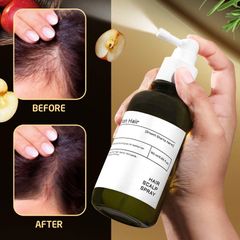 Xịt Dưỡng Tóc Lab On Hair 160ml - Hỗ Trợ Mọc Tóc Giấm Táo, Redensyl, Multi Peptide, Chiết Xuất Hương Thảo