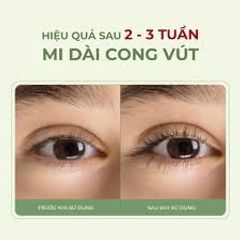 Serum Dưỡng Mi ABERA - Tăng Cường Độ Dài & Đày, Giúp Mi Tự Nhiên Chắc Khỏe Không Gãy Rụng, Chiết Xuất Hồng Sâm & Aloe Vera