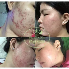 Bột sâm đông y Hạnh Sino 100% thiên nhiên tái tạo da - Giúp da khỏe đẹp từ gốc, giảm mụn thâm nám, phục hồi tự nhiên - Dung tích 100ml