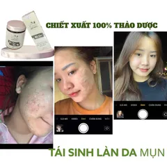 Bột sâm đông y Hạnh Sino 100% thiên nhiên tái tạo da - Giúp da khỏe đẹp từ gốc, giảm mụn thâm nám, phục hồi tự nhiên - Dung tích 100ml