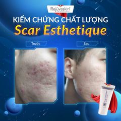 Kem Xóa Sẹo Thâm, Rỗ, Lõm Scar Esthetique 10ml, 30ml, 60ml - Rejuvaskin USA, Giải Pháp Làm Mịn Da, Tự Nhiên và Hiệu Quả