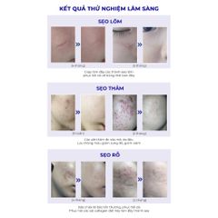 Kem Xóa Sẹo Thâm Scar Esthetique 60ml - Giúp Lấp Đầy Sẹo Rỗ, Sẹo Lõm, Chăm Sóc Da Mặt Từ Rejuvaskin USA