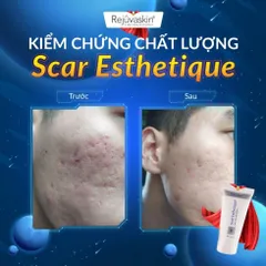 Kem làm mờ Sẹo Scar Esthetique Rejuvaskin 10ml - Chuyên dùng cho sẹo thâm, sẹo rỗ, ngăn ngừa sẹo lồi, an toàn cho mọi loại da