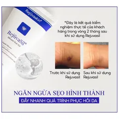 Gel Silicone Ngăn Ngừa Sẹo RejuvaSil 30ml - Làm Xẹp Sẹo Lồi, Phục hồi Da, An Toàn Cho Trẻ Em, Giảm Ngứa, Kích Ứng
