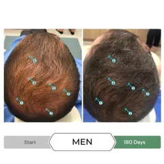 Serum Kích Thích Mọc Tóc SPECTRAL.CBD 60ml - Ngăn Gãy Rụng và Giảm Gàu - Sản Phẩm Từ Mỹ Cho Tóc Dày Đẹp Hơn