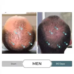 Serum Kích Thích Mọc Tóc SPECTRAL.F7 60ml - Giảm Gãy Rụng Tóc, Phục Hồi Mái Tóc Dày và Đầy Đặn cho Nam Nữ