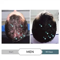 Serum Kích Thích Mọc Tóc SPECTRAL.F7 60ml - Giảm Gãy Rụng Tóc, Phục Hồi Mái Tóc Dày và Đầy Đặn cho Nam Nữ
