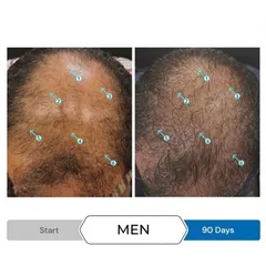Serum kích thích mọc tóc SPECTRAL.UHP® 60ml cho nam, giảm gãy rụng, hồi sinh nang tóc - Mỹ, phù hợp cho tóc mỏng và sau cấy tóc