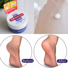 Kem Hỗ Trợ Giảm Nứt Gót Chân, Ngón Tay Shiseido UREA Cream (H/100gr)