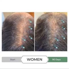 Dầu Xả Kích Thích Mọc Tóc Revita.CBD 205ml - Chống Oxy Hóa, Tăng Độ Dày và Khỏe Mạnh Tóc, An Toàn Không Sunfat