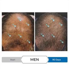 Serum Kích Thích Mọc Tóc SPECTRAL.UHP® 60ml cho Đàn Ông - Trị Gãy Rụng Tóc Hiệu Quả từ Ds Laboratories (Mỹ)