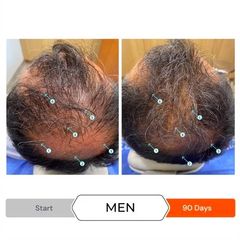 Dầu Xả Kích Thích Mọc Tóc REVITA CONDITIONER 205ML - Giảm Rụng, Tăng Cường Độ Dày Tóc Từ Ds Laboratories (Mỹ)