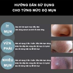Gel Hút Mụn Than Tre Hoạt Tính KONE 50ml - Mặt Nạ Lột Mụn Cám & Đầu Đen, Sạch Da, Tặng Cọ, An Toàn Cho Da Nhạy Cảm