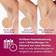 Máy Triệt Lông Philips Lumea Advanced IPL BRI923 - Công Nghệ IPL Hiện Đại, Giúp Da Mịn Màng, Không Đau, Dùng Cho Mặt, Nách, Bikini