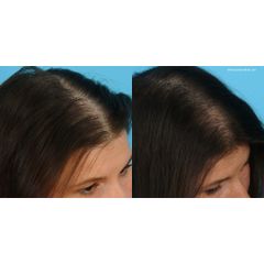 Tinh Dầu Dưỡng Tóc Hương Bạc Hà YANAGIYA - Tonic Mọc Tóc Trị Gãy Rụng, Giúp Tóc Dày Đẹp, 240ml Nhật Bản