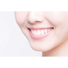 Kem Đánh Răng Aquafresh Extra Fresh + Whitening - 158.8g - Xanh