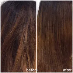 Dầu gội giảm gàu dành cho mọi loại tóc L'ORÉAL Serie Expert Scalp Advanced - 500ml