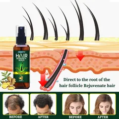 Serum dưỡng mọc tóc, giúp tóc mọc nhanh, nhiều và dày, sợi tóc đen bóng Nhật Bản - Giúp Tóc Dày Khỏe, Bóng Mượt và Ngăn Gãy Rụng - Sản Phẩm Chăm Sóc Tóc Tự Nhiên - Mã 1230