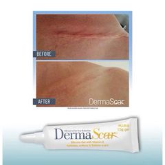Gel Bôi Sẹo DermaScar Silicone Plus E 15g - Gel Chăm Sóc Da Mịn Màng với Vitamin E 10% cho Vết Sẹo Lồi Hồi Phục Hiệu Quả