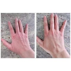 KEM DƯỠNG DA TAY KHÔ, NỨT DERMAL THERAPY HAND BALM TUÝP 50G