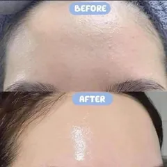 Serum B5 La Roche Posay 10ml