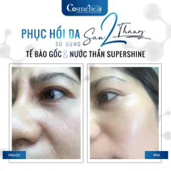 Tế Bào Gốc Cosmeheal Supershine Ampoule - Phục Hồi Căng Bóng Da, Giảm Nhăn, Cấp Ẩm Chống Lão Hoá - Dưỡng Da Hàn Quốc Chính Hãng