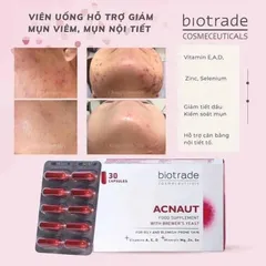 Viên Uống Giảm Mụn Biotrade Acnaut - Thực Phẩm Chức Năng 30 Viên, Hỗ Trợ Da Sáng Khỏe, Giảm Thâm, Kiềm Dầu