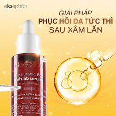 Ekseption Hyaluronic B5 Serum - Tinh Chất Cấp Ẩm Phục Hồi Làm Dịu Da - 75ml Cho Da Khô Mỏng Yếu