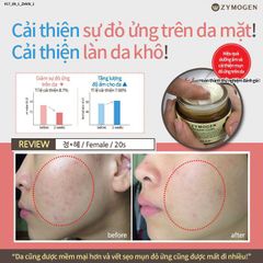 Kem Dưỡng Rau Má Lên Men Zymogen Centella Ferment Cream - Chống Lão Hóa, Tái Tạo Da, Ngừa Mụn, Mờ Thâm, Làm Dịu Da