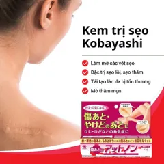 Kem Mờ Sẹo Ex Kobayashi 15g - Giải Pháp Làm Sáng Da, Mờ Thâm Mụn, Sẹo Lồi và Sẹo Rỗ Nhập Khẩu Nhật Bản