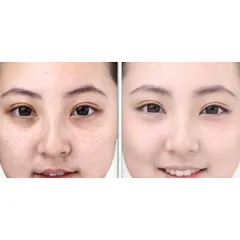 Kem dưỡng ẩm Haku Shiseido HAKU Melano Deep Moisture 100g Nội Địa Nhật Bản 292518