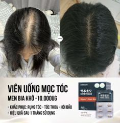 Viên Uống Hỗ Trợ Mọc Tóc Biotin Brewer's Yeast Sejong - Hộp 60 Viên, Giúp Tóc Khỏe, Giảm Rụng, Tăng Độ Dày Tóc